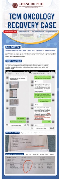 Preview of the complete English small-cell lung cancer case poster
